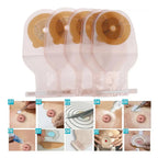 10x Bolsa Colostomía Drenable Con Filtro Anti Olor Y Gases 6