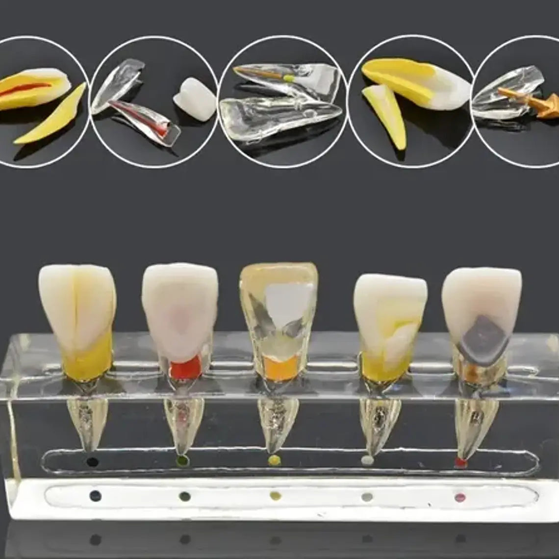 Modelo Endodoncia Dental Acrílico Enseñanza Didáctico Stgo. 10