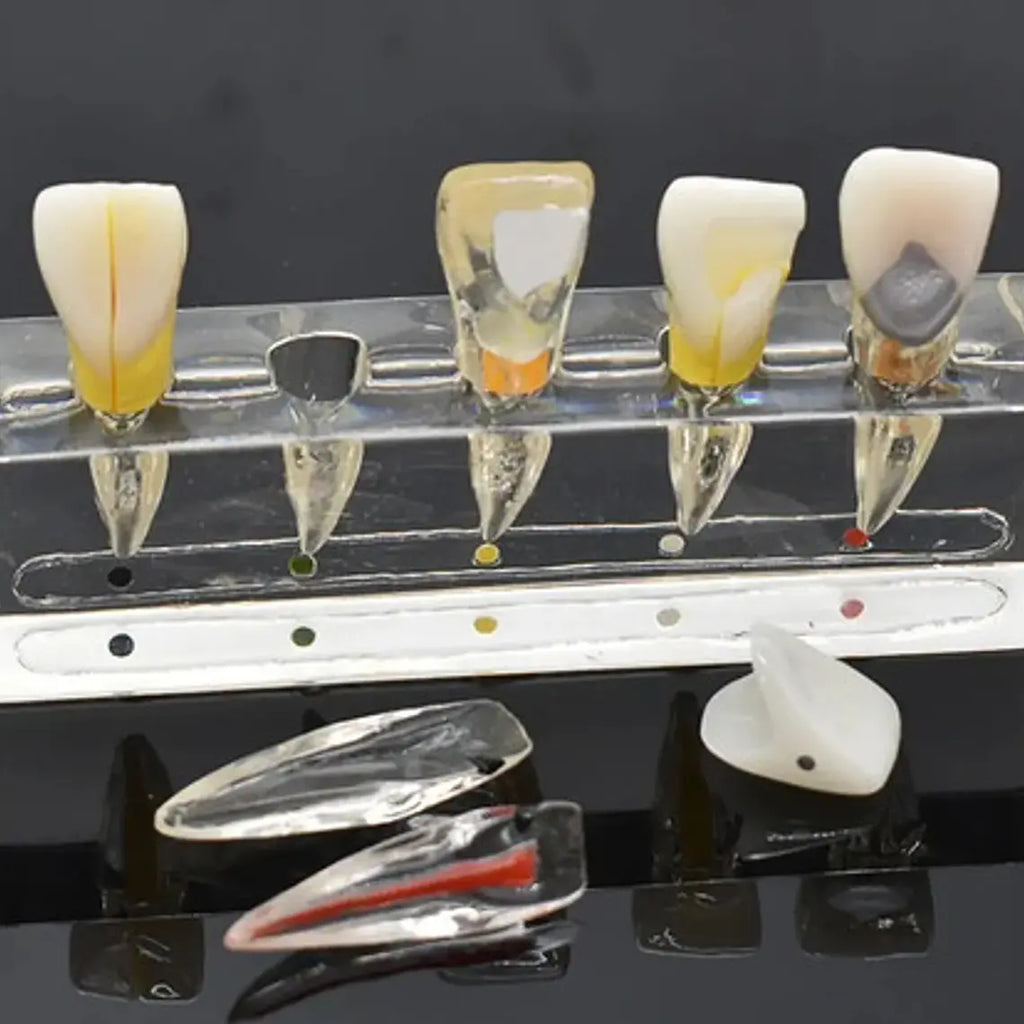 Modelo Endodoncia Dental Acrílico Enseñanza Didáctico Stgo. 8