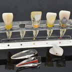 Modelo Endodoncia Dental Acrílico Enseñanza Didáctico Stgo. 8