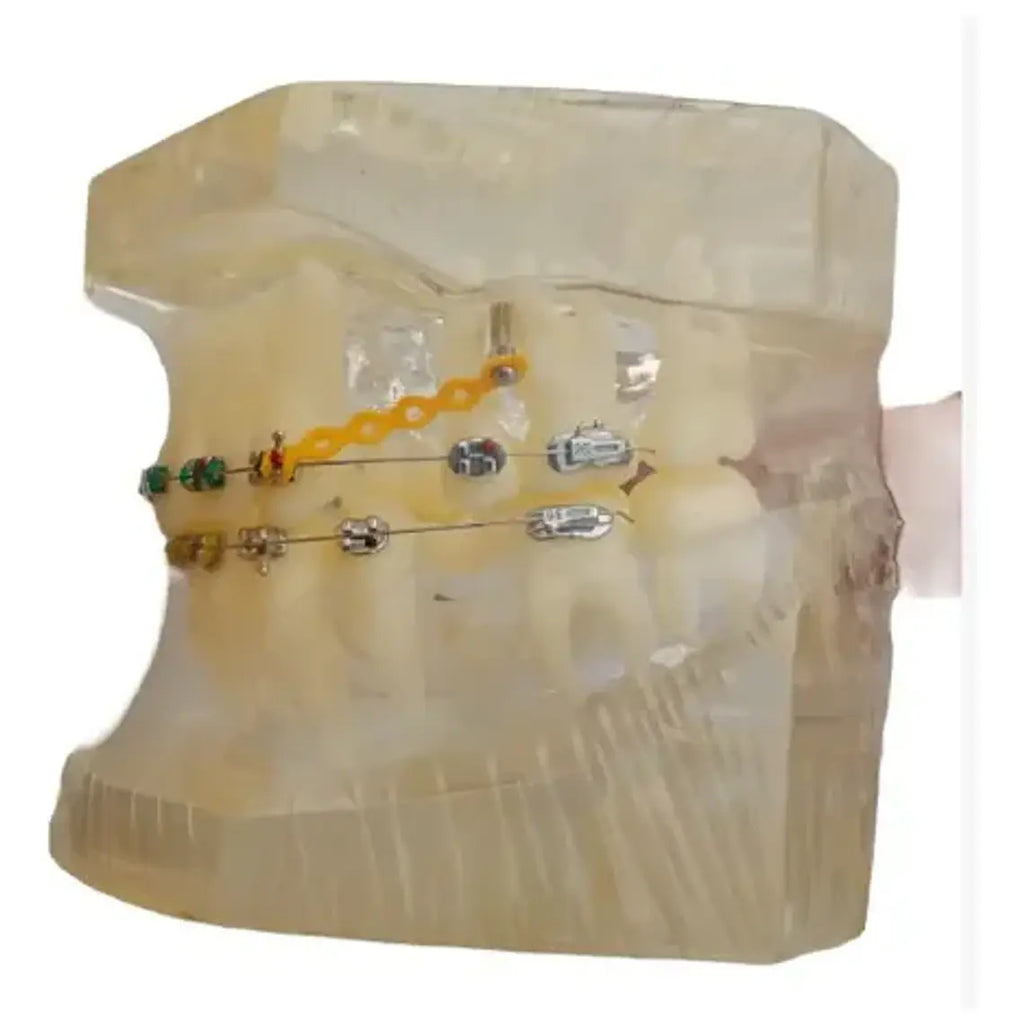 Modelo Dental Ortodoncia Brackets Normal Acrílico Transp 3