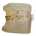 Modelo Dental Ortodoncia Brackets Normal Acrílico Transp 3