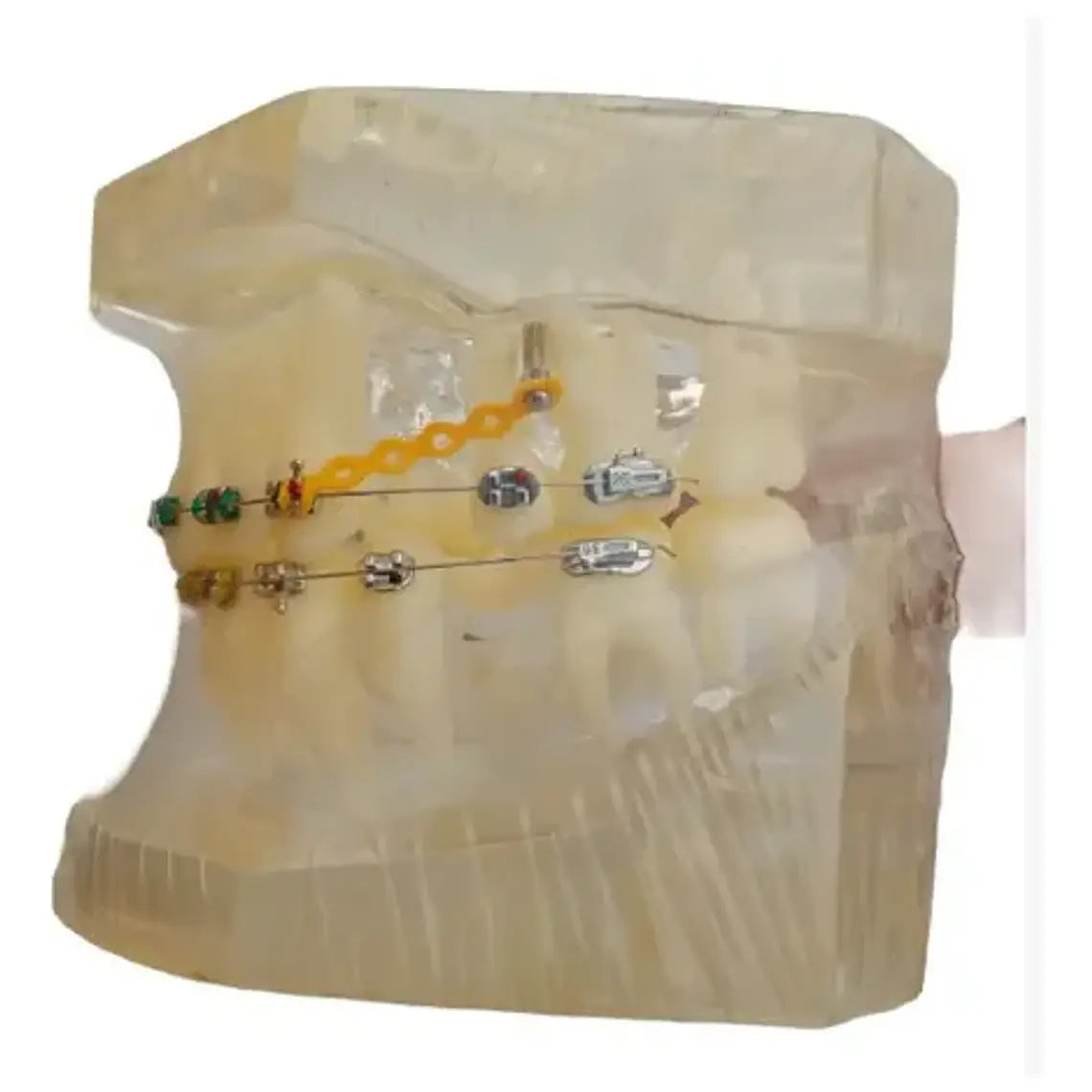Modelo Dental Ortodoncia Brackets Normal Acrílico Transp 3
