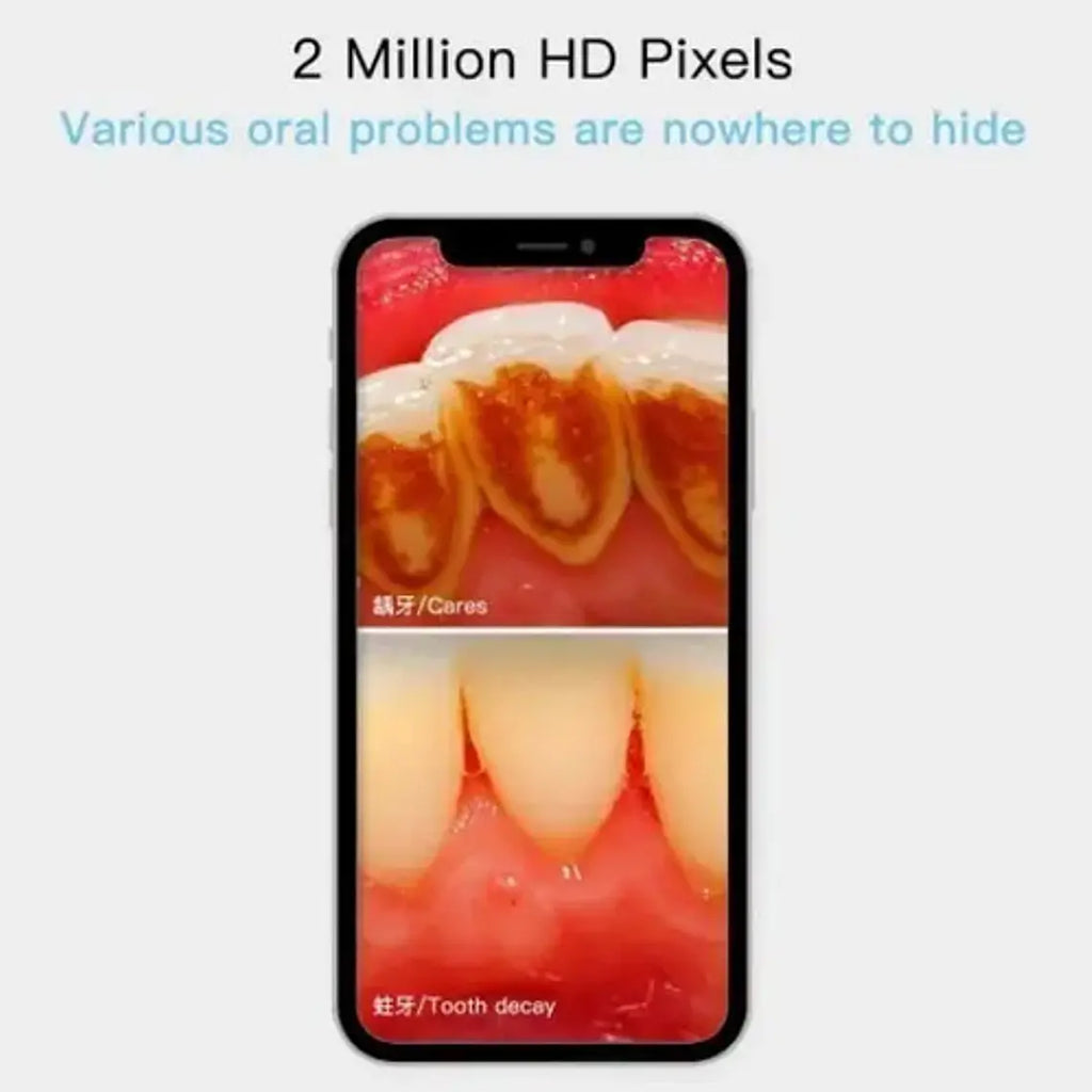 Camara Intraoral Wifi Inalámbrica Led Santiago 7
