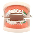 Modelo Dental Ortodoncia Enseñanza Y Estudio Santiago 1
