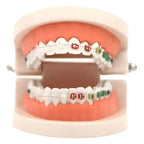 Modelo Dental Ortodoncia Enseñanza Y Estudio Santiago 1
