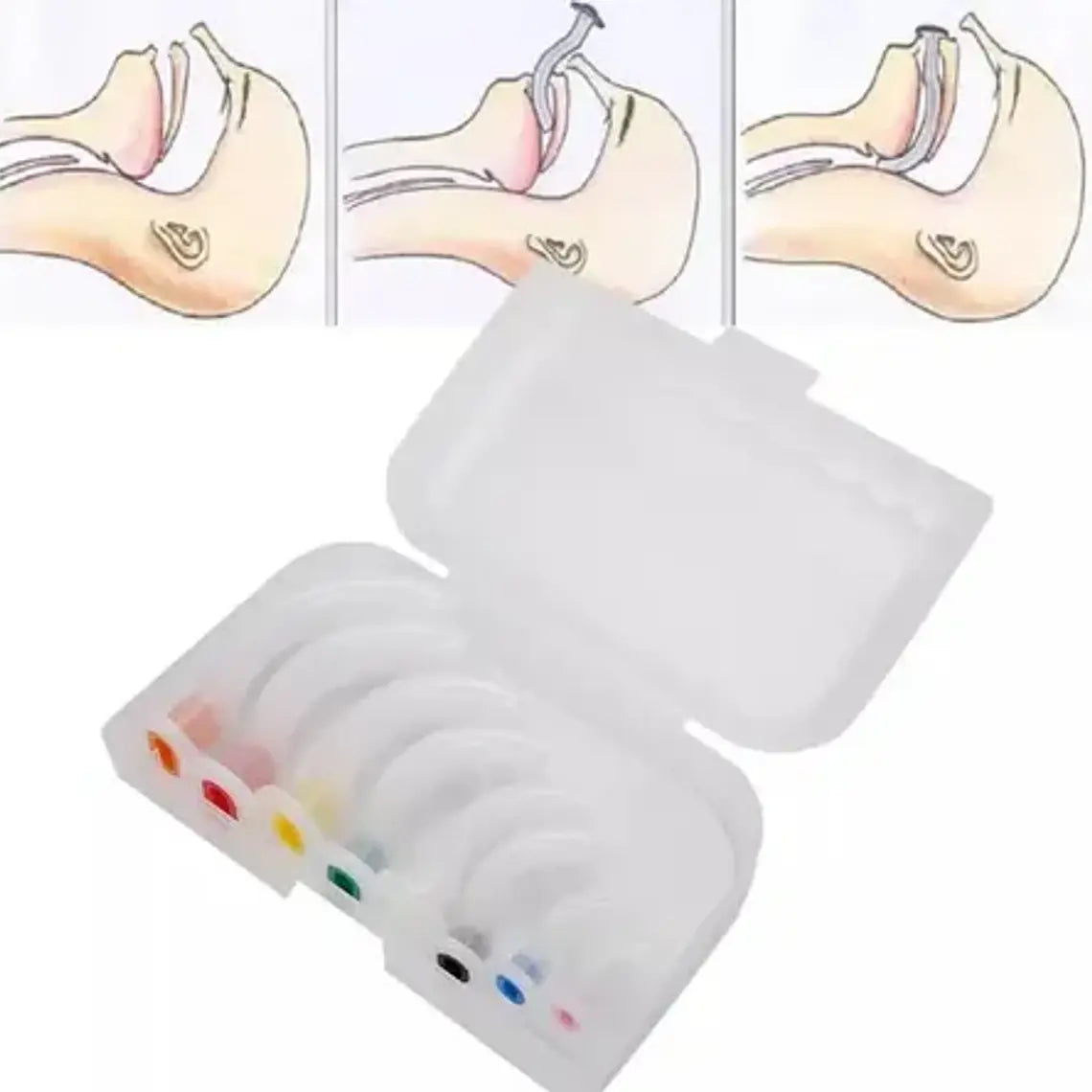Set De Cánulas Orofaríngeas ( Mayo O Guedel) - 8 U. En Caja 7