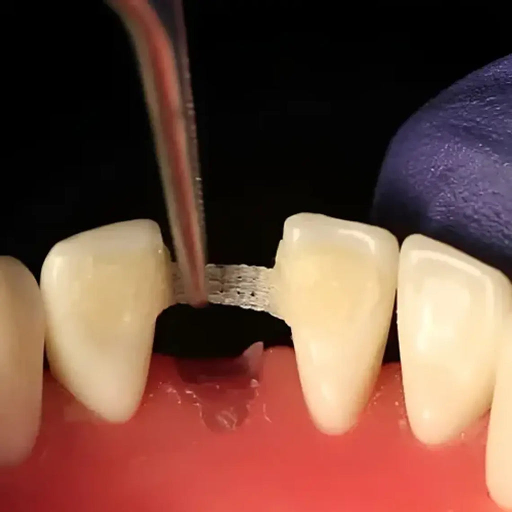 Banda De Refuerzo Dental Tira De Fibra Tipo Ribbon 1 Rollo 9