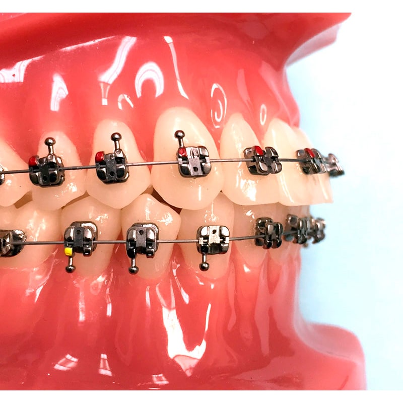 Kit Bracket Autoligado Agility | G&H Orthodontics