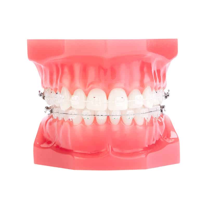 Kit Bracket Zafiro ClearViz+ | Dynaflex