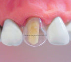 Corona Trans Inf Ant X54 Tdv (4154)