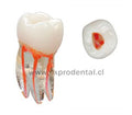 Diente Acril Endo Entrenamiento Vdw