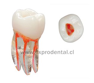 Diente Acril Endo Entrenamiento Vdw