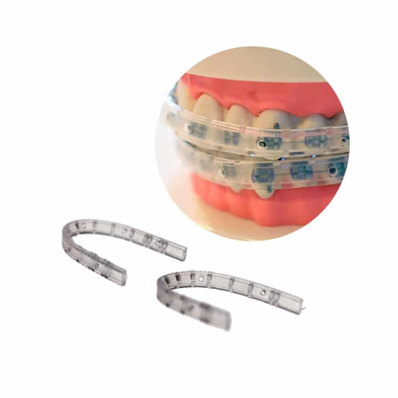 Protector para Arcos y Brackets | Tecnident
