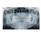 Rx Ext 2D/C X-Mind Prime 1S Acteon