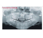 Rx Ext 2D/C X-Mind Prime 1S Acteon