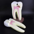 Modelo estudio Molar Magnético Machtig