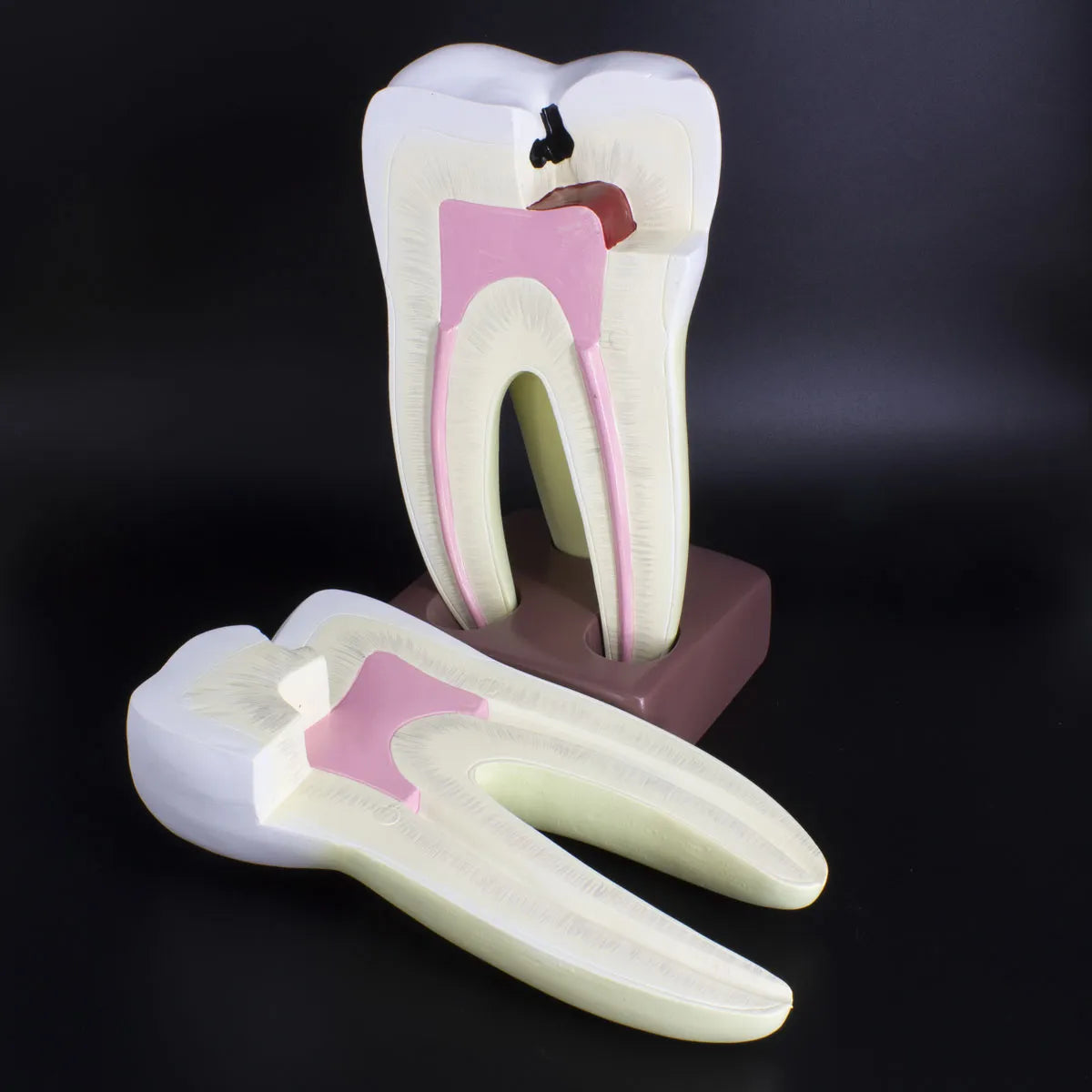 Modelo estudio Molar Magnético Machtig