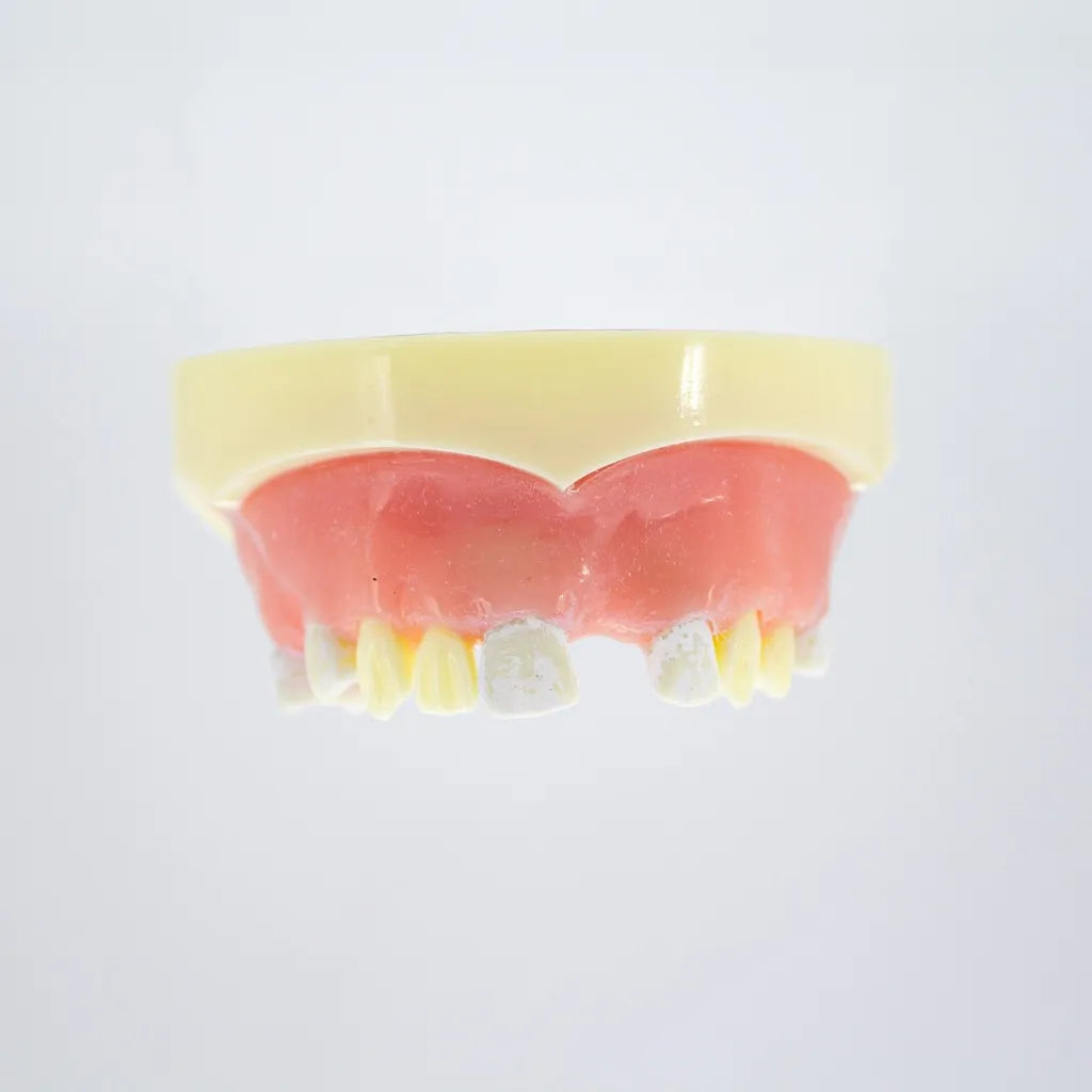 Modelo estudio y práctica Implantología con encía Max. Superior CBCT Machtig