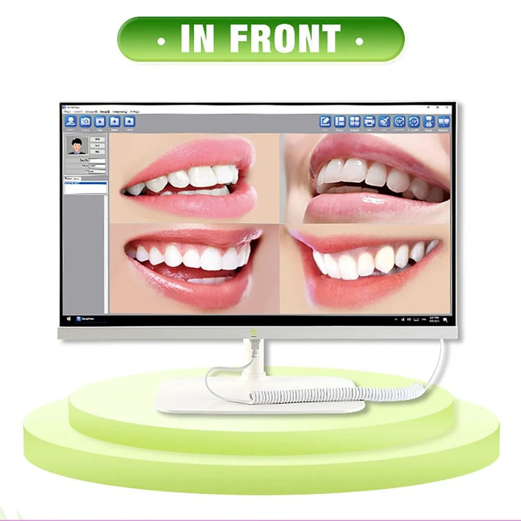 Set Monitor computador + Cámara intraoral de Sobremesa Eco-Camera 01 Appledental