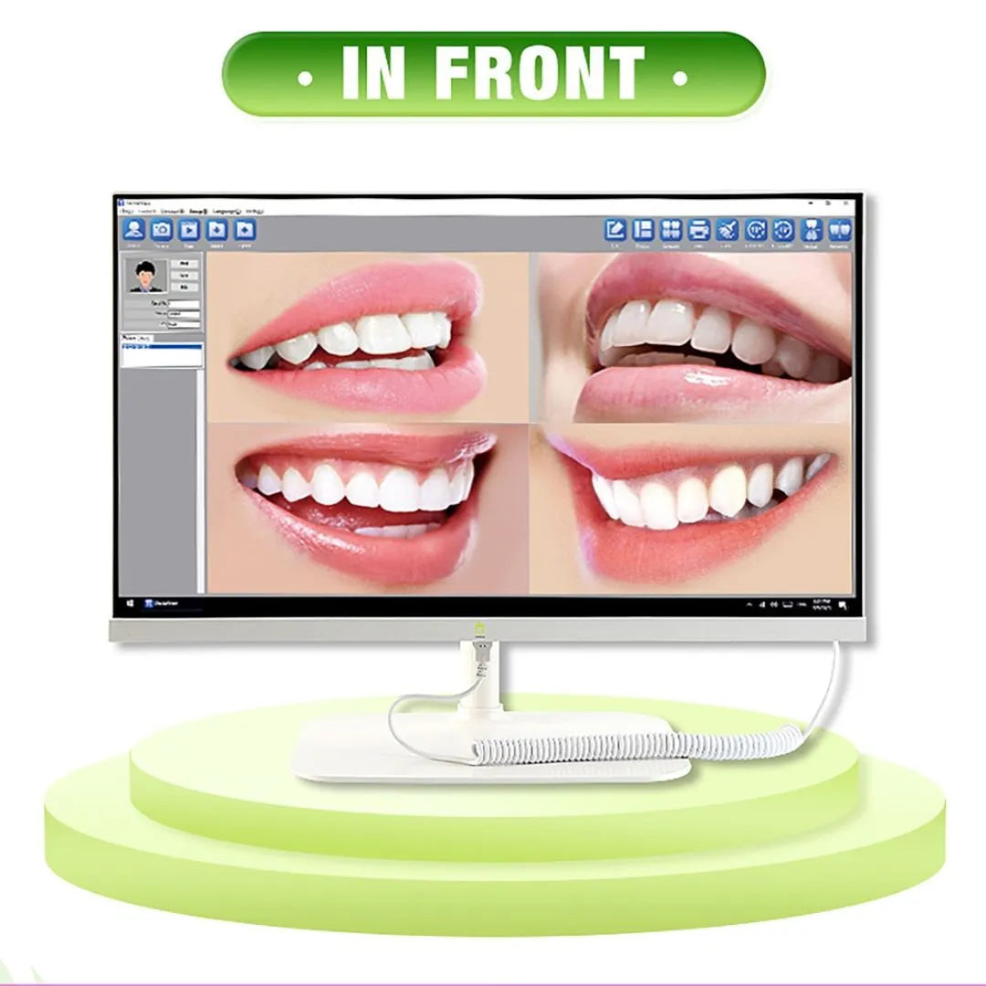 Set Monitor computador + Cámara intraoral de Sobremesa Eco-Camera 01 Appledental