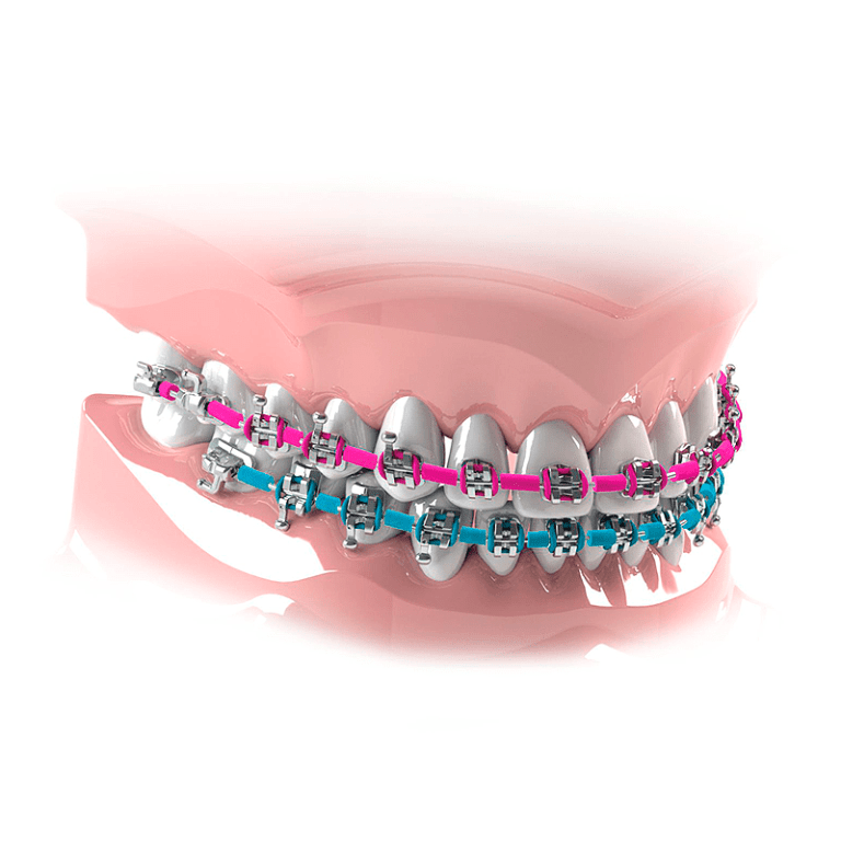 Goma Cubre Arco Color | Morelli