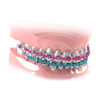 Goma Cubre Arco Color | Morelli