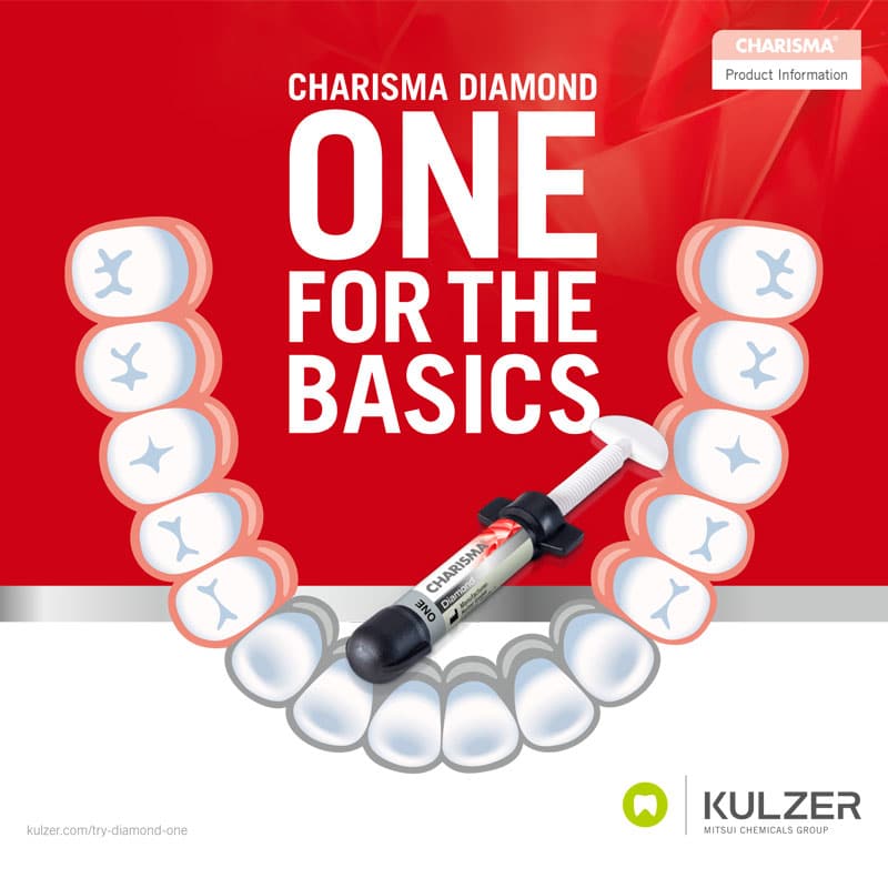 Charisma Diamond ONE 4 gr | Kulzer