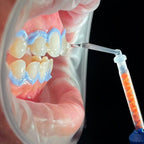 Pola Rapid Blanqueamiento Dental SDI