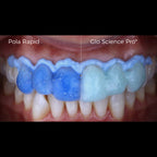 Pola Rapid Blanqueamiento Dental SDI