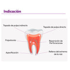 MTA CEMENTO REPARADOR ENDOCEM PREMIXED MARUCHI 2GR