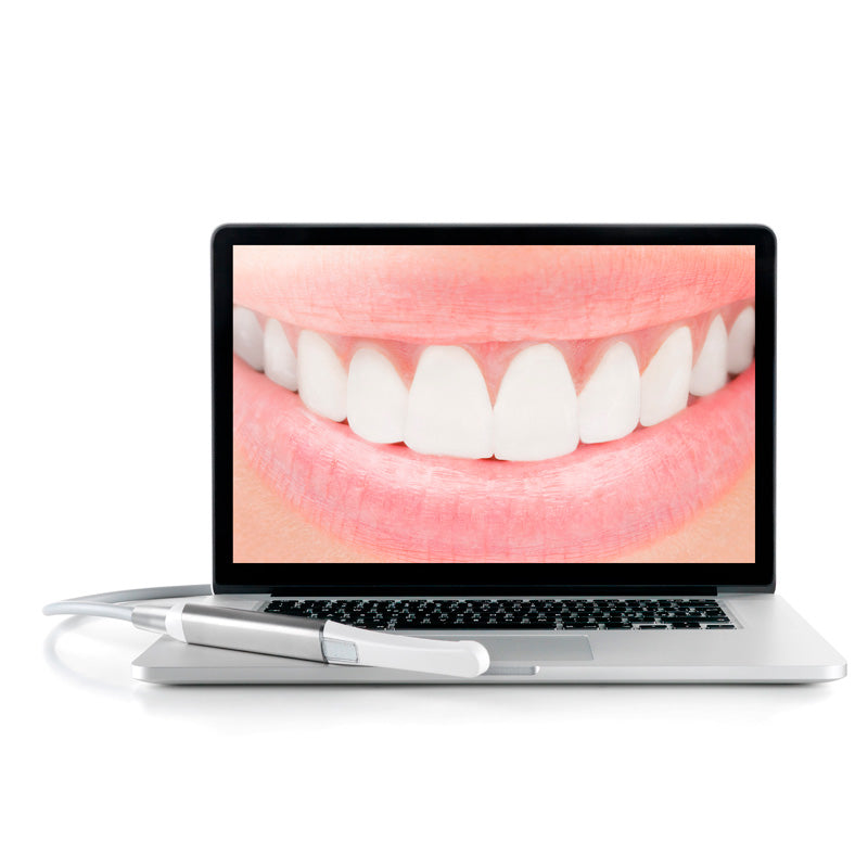 Cámara Intraoral - CU2 HD