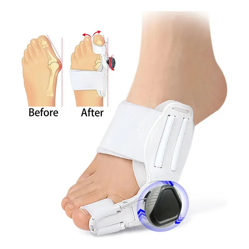 Corrector de Juanete Reegulable - FeetiFix