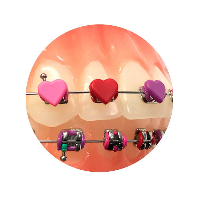 Ligadura DesignerTies | G&H Orthodontics