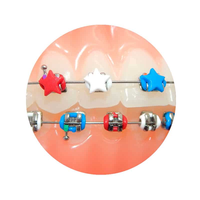 Ligadura DesignerTies | G&H Orthodontics