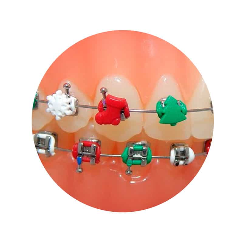 Ligadura DesignerTies | G&H Orthodontics
