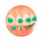 Ligadura DesignerTies | G&H Orthodontics