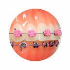 Ligadura DesignerTies | G&H Orthodontics