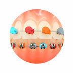 Ligadura DesignerTies | G&H Orthodontics