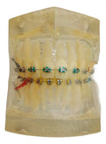 Modelo Dental Ortodoncia Brackets Normal Acrílico Transp