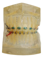 Modelo Dental Ortodoncia Brackets Normal Acrílico Transp