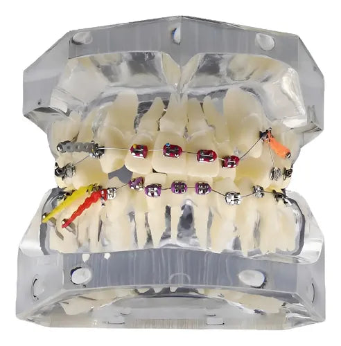 Modelo Dental Ortodoncia Brackets Acrilico Con Adm Santiago