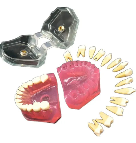 Modelo Acrílico Único Dientes Desmontables Encía Enseñanza