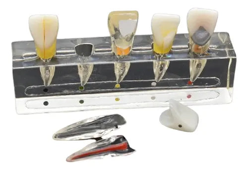 Modelo Endodoncia Dental Acrílico Enseñanza Didáctico Stgo.