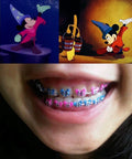 Ligaduras Ortodoncia De Mickey Mouse Colores 1000u Santiago