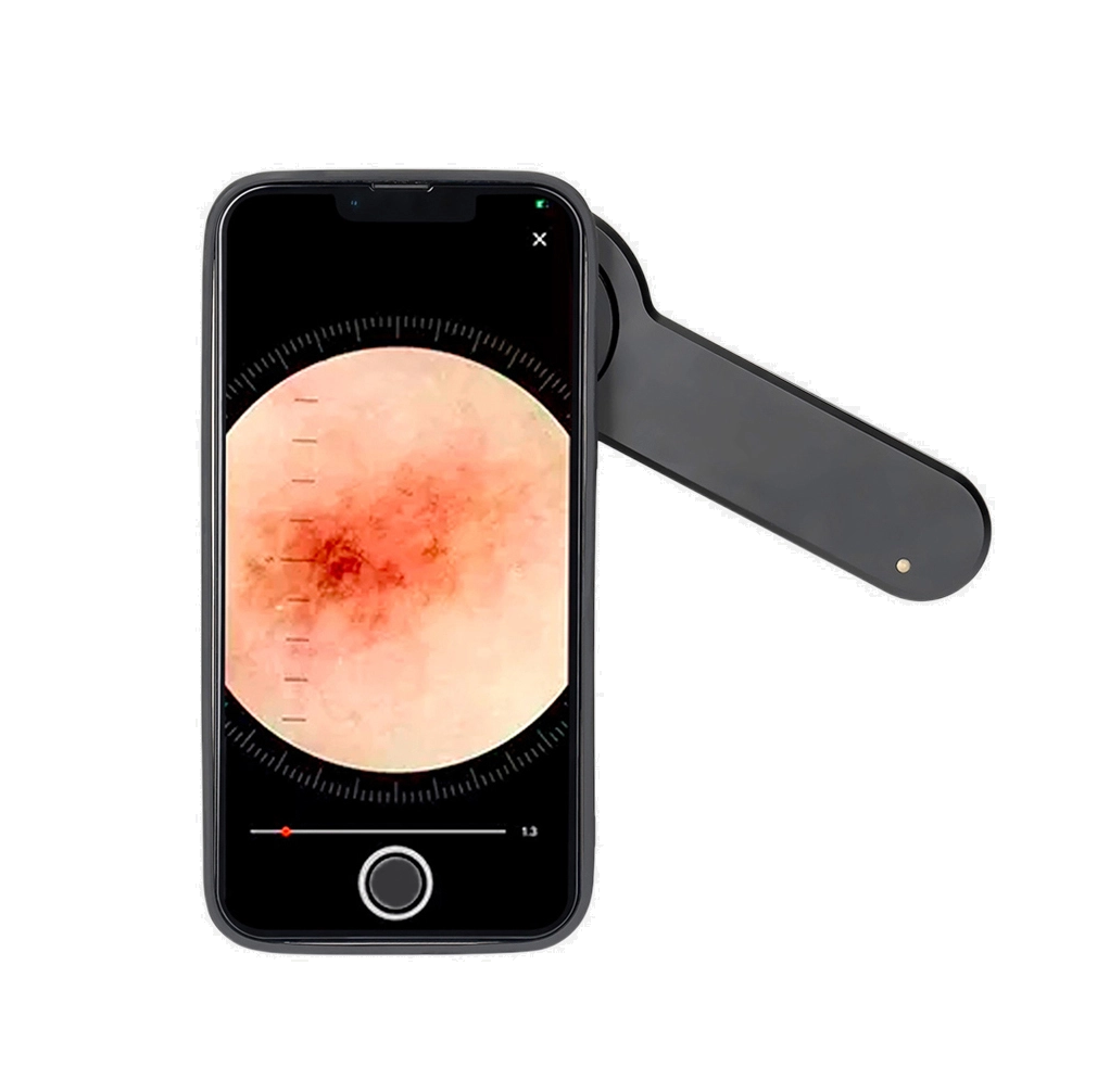 Dermatoscopio DE-3100