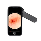 Dermatoscopio DE-3100