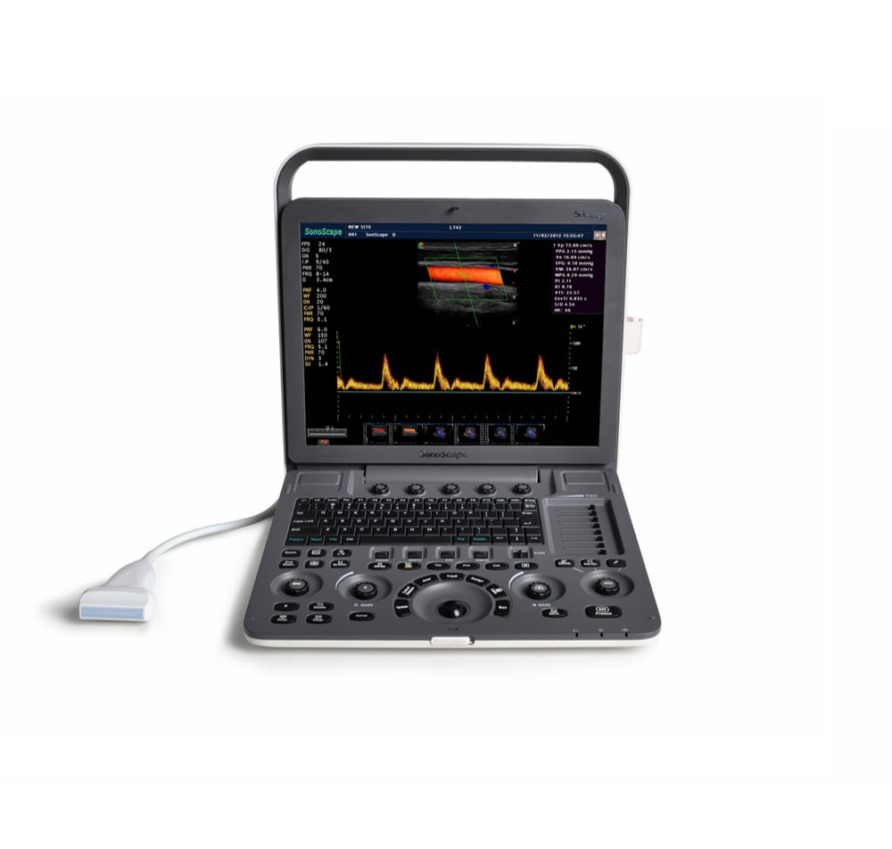 Ecógrafo doppler color Sonoscape S8 EXP_3