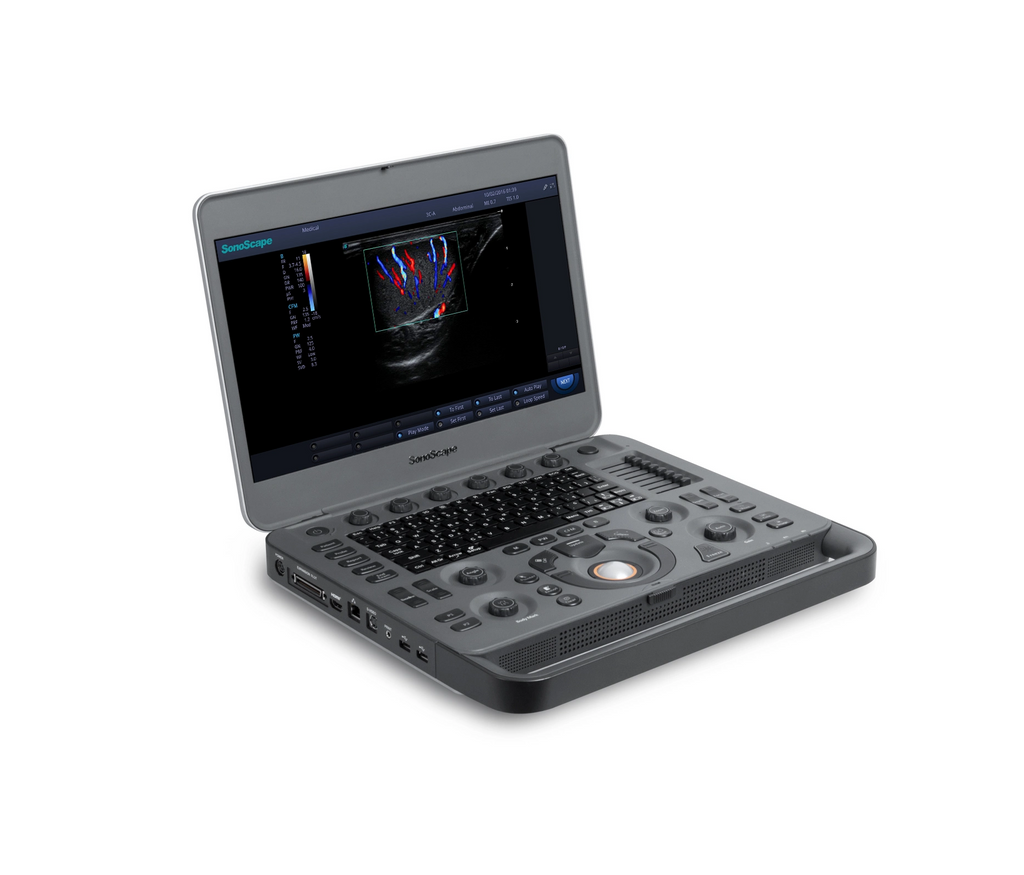Ecografo doppler color Sonoscape X5_2
