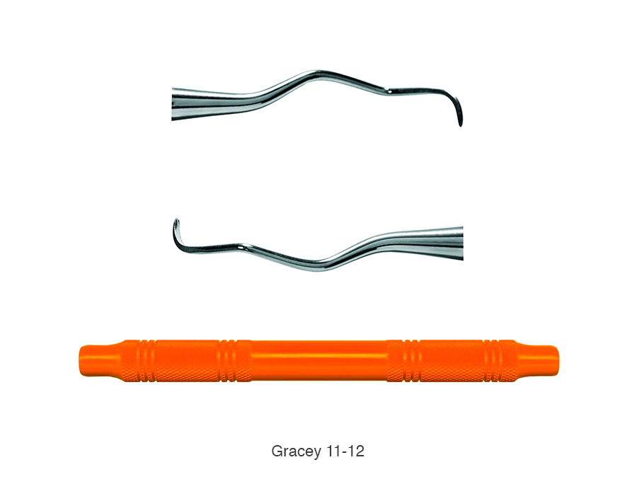 Gracey STD